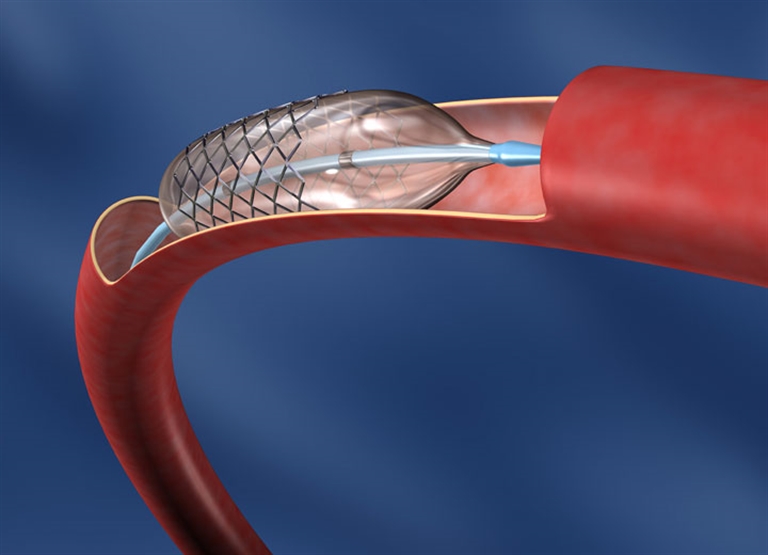Humidificación para la industria de insumos médicos